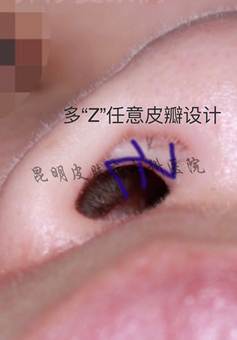 441f1c9c50fb015469f4d556b5acca1.jpg